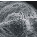 An Overview of Varicella-zoster Virus (VZV) Structure and Replication Cycle