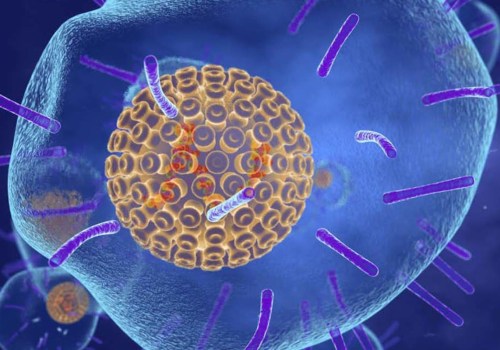 Exploring the History of Chickenpox and Shingles