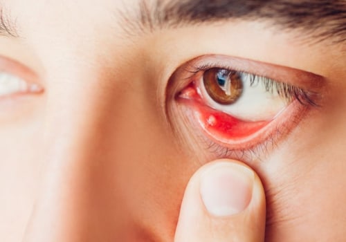 Eye Problems: An Overview of Symptoms, Causes, and Treatments